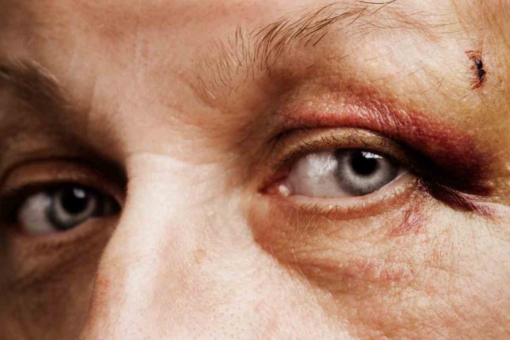  délais pour porter plainte selon la gravité des coups et blessures 